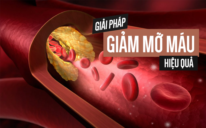 Tinh Dầu Thông Đỏ - Giảm mỡ máu