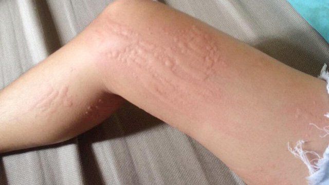 Siêu Thị Thuốc Tây