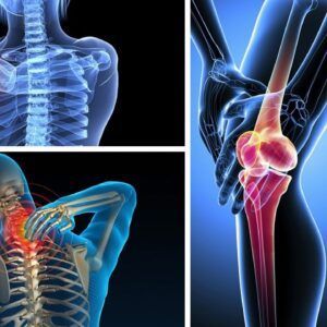 đau nhức xương khớp