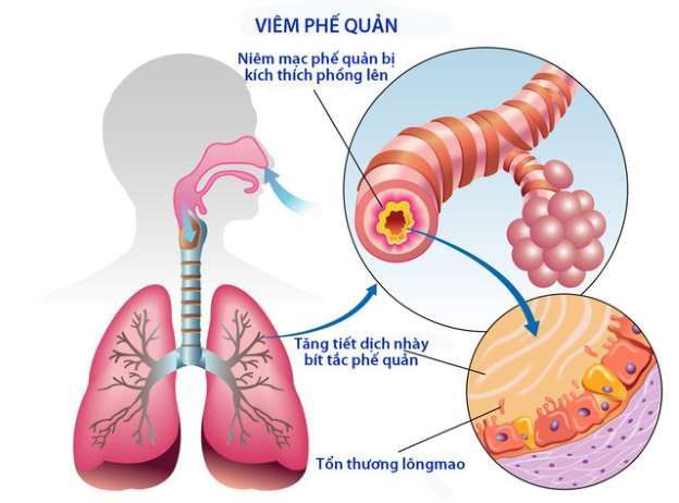 Bổ Phế Chỉ Khái Lộ Hộp 24 Viên - Giúp Điều Trị Ho Hiệu Quả