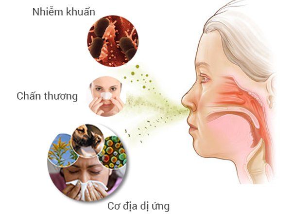 Glotizin Hộp 100 Viên - Trị Triệu Chứng Viêm Mũi Dị Ứng